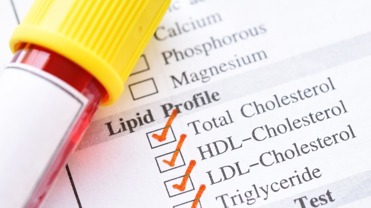 Check Up Diabete e Metabolismo Lipidico IRCCS Ospedale Sacro Cuore Don Calabria