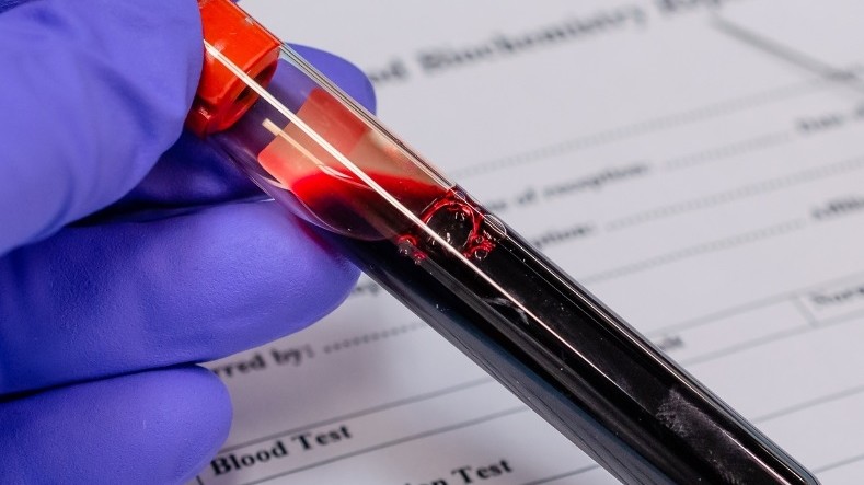 Check Up Prevenzione Funzionalità Epatica