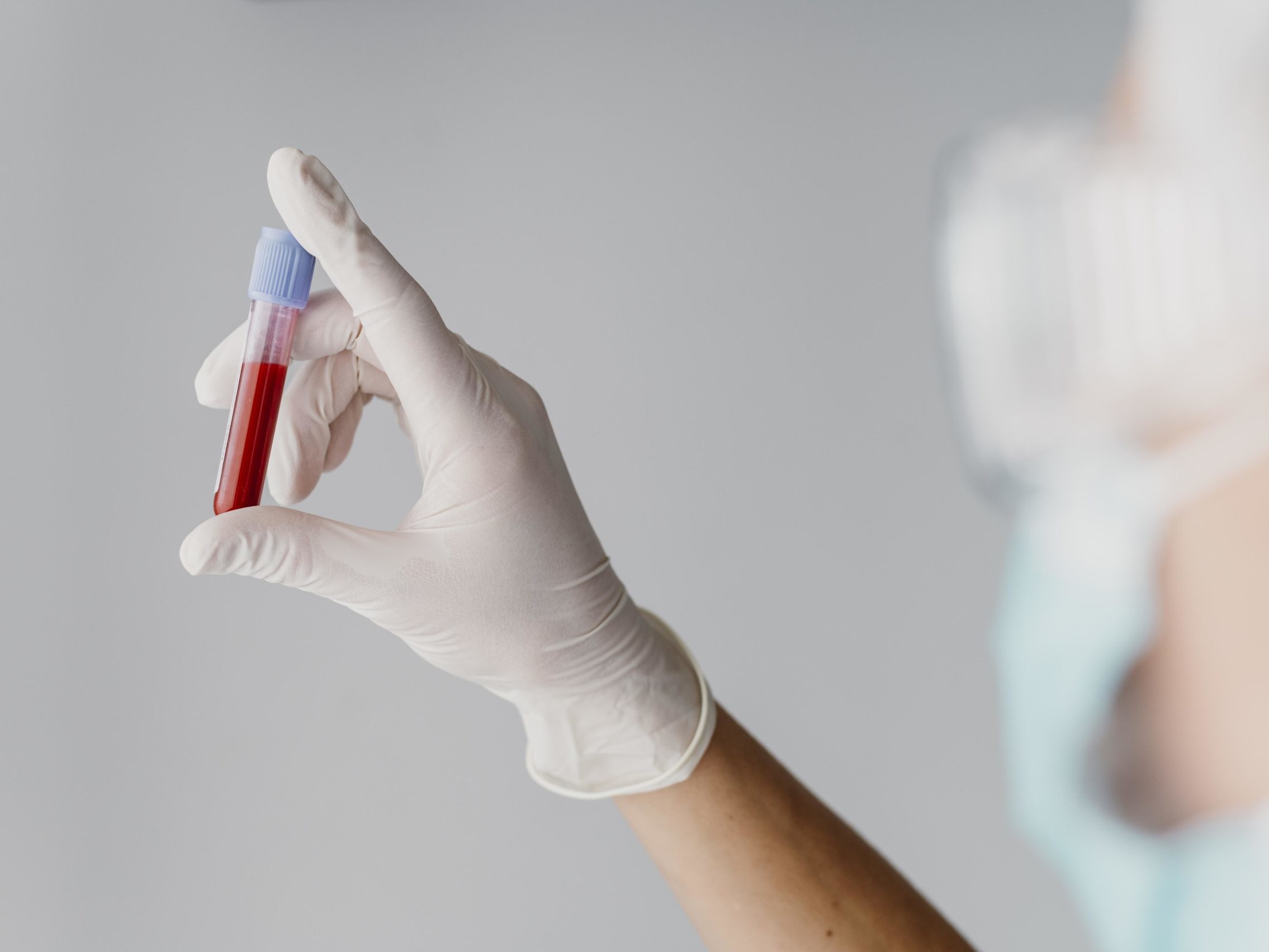 prelievi sangue Ospedale Sacro Cuore Don Calabria