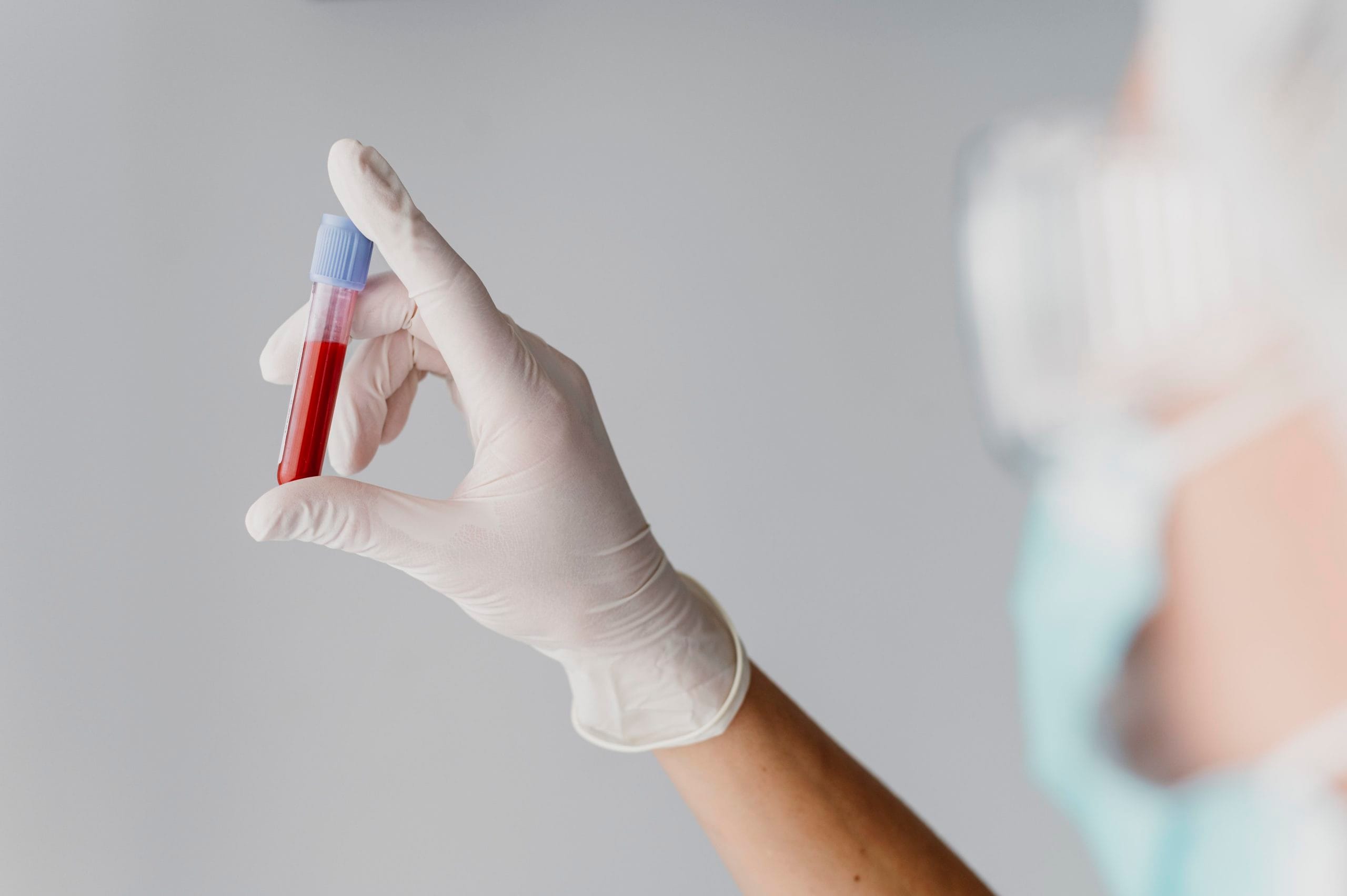 prelievi sangue Ospedale Sacro Cuore Don Calabria